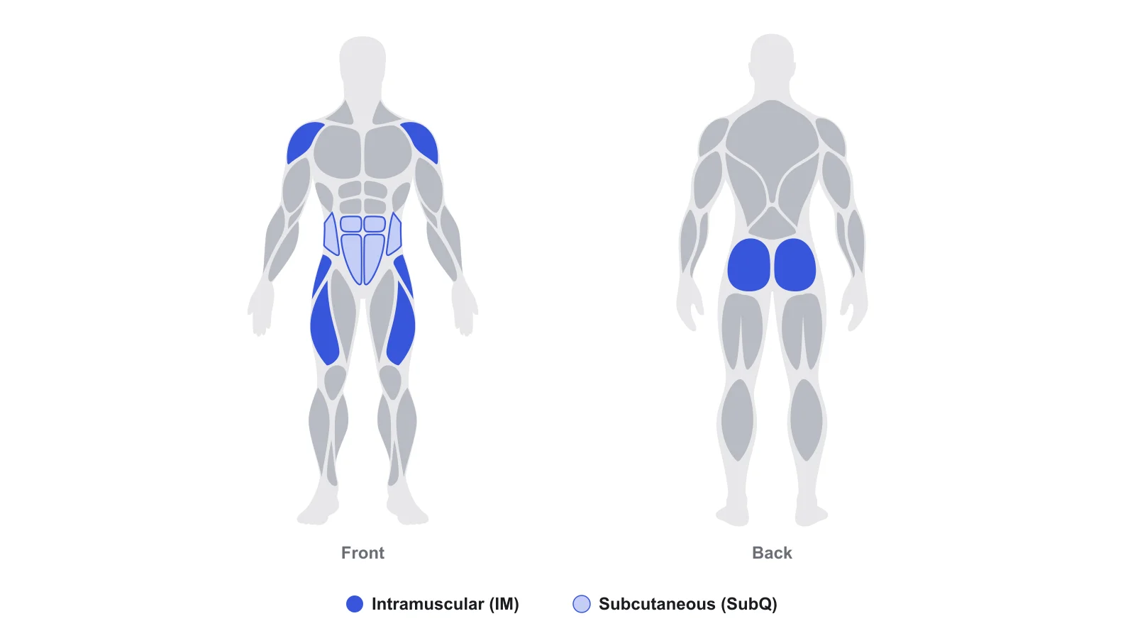 Front and back body map from the TRTracker app with intramuscular injection sites in dark blue (shoulders, sides of the hips, outer thighs, glutes) and subcutaneous sites in light blue (belly and love handles).