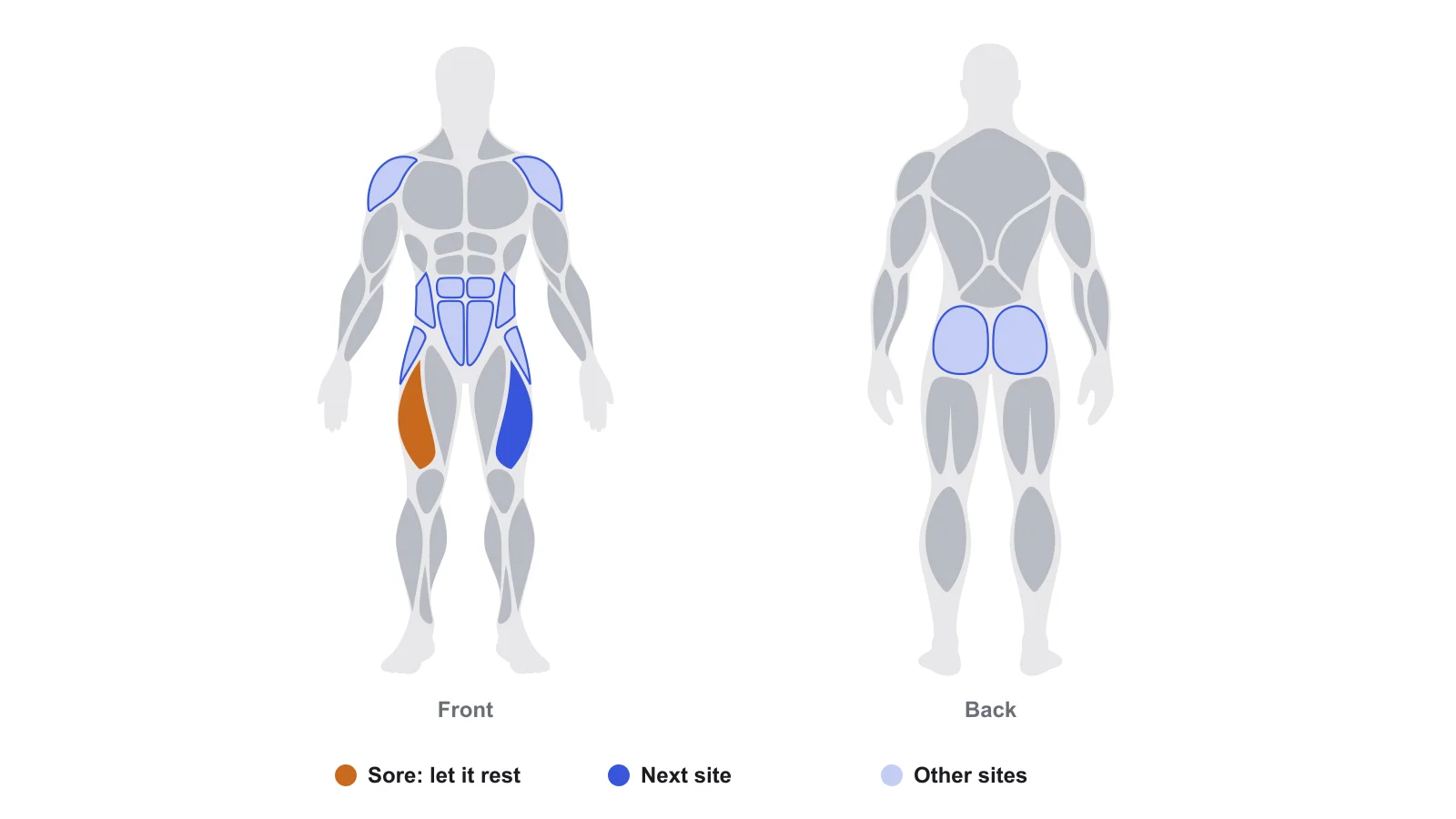 Front and back body map from the TRTracker app with a sore outer-thigh site resting in orange, the other outer thigh marked as the next site in dark blue, and the other sites in light blue.